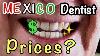 Cost Of Dental Work Ajijic Mexico