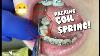 Dental Braces Packing Coil Spring Tooth Time Family Dentistry New Braunfels