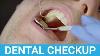 Dental Checkup Appointment Demonstrated U0026 Explained