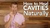 How To Treat Cavities Naturally Dr Josh Axe