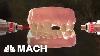 New Stem Cell Research Could Put An End To Dental Visits Mach Nbc News
