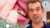 The Truth About Your Teeth Medical Documentary Real Stories