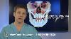Conseil Certifié Oral U0026 Chirurgiens Maxillofaciaux Implants Dentaires Webinaire Dr David Kirkpatrick