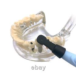 Détecteur intelligent sans fil 3D pour localisation de l'implant médical dentaire à rotation de 270°