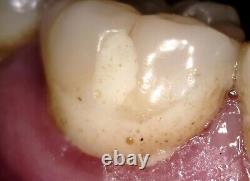 Polaroid P720 Caméra Intra-orale Filaire/sans Fil (dentaire, Médicale)
